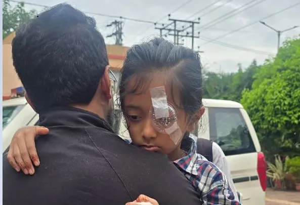 Bhubaneswar: Class IV student hospitalized with severe eye injuries after beating by teacher